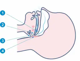 Chrapanie przyczyny: jakie są najczęstsze powody chrapania?