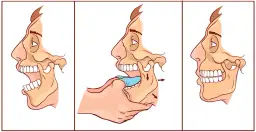 Objawy nowotworu stawu skroniowo-żuchwowego, których nie możesz zignorować