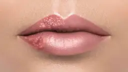 Opryszczka na ustach a dentysta: Kiedy wizyta jest bezpieczna?