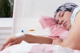 Chemia po operacji jelita grubego: Kiedy zacząć? Kluczowe terminy