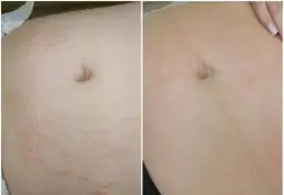 Gdzie kupić deep phyto peeling i uniknąć nieefektywnych produktów