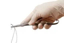 Czy ściąganie szwów z dziąsła boli? Poznaj prawdę o bólu i dyskomforcie