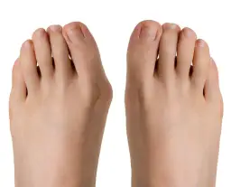 Jak dbać o stopę po operacji haluksa, aby uniknąć bólu i komplikacji