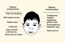 Syndrom dziecka alkoholika objawy: Jak rozpoznać skutki dzieciństwa?