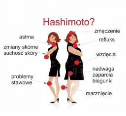 Hashimoto objawy psychiczne - jak rozpoznać i zrozumieć ich wpływ