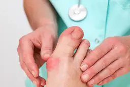 Co najlepsze na haluksy? Skuteczne metody na ulgę i komfort