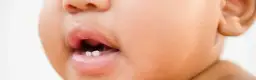 Jak wyglądają dziąsła niemowlaka przy ząbkowaniu – zdjęcia i objawy