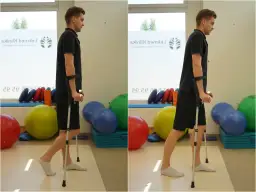 Jakie ćwiczenia po złamaniu kłykcia pomogą w szybszej rehabilitacji?