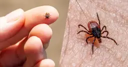 Zbliżenie na kleszcza na palcu i kleszcza na skórze.