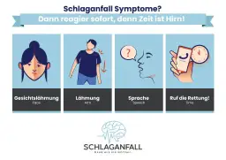 Hirnschlag Symptome: So erkennen Sie die alarmierenden Anzeichen