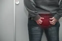 Skuteczne metody na ból odbytu – jak leczyć i uniknąć cierpienia