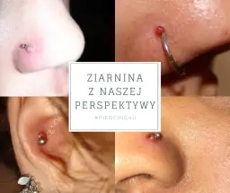 Infekcja kolczyka w pępku: Jak rozpoznać objawy i skutecznie leczyć?