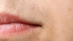 Jak skutecznie usunąć wąsik? Przewodnik po metodach i pielęgnacji