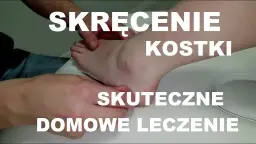 Skręcona kostka co robić: skuteczne metody na szybkie wyleczenie