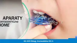 Jak zakładać aparat ruchomy? Poradnik krok po kroku od ortodonty