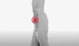 Czy warto operować haluksy? Poznaj korzyści i ryzyko operacji