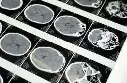 Teleradiologia – jak działa i dlaczego coraz częściej zastępuje tradycyjne opisy badań?