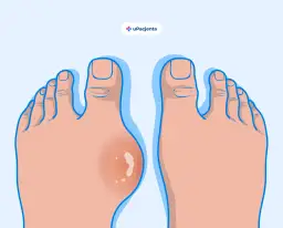 Dna moczanowa objawy: pierwsze sygnały ostrzegawcze, które musisz znać