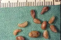 Jaja przywry w kale - jak rozpoznać obecność pasożytów jelitowych?