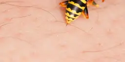 Skutki uboczne odczulania na jad osy: jakie reakcje mogą wystąpić?