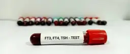 FT3 co to za badanie i jak wpływa na Twoje zdrowie tarczycy