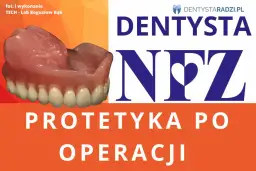 Gdzie zrobić protezę zębową na NFZ i uniknąć długiego czekania