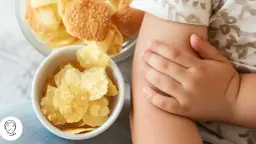 Objawy skórne celiaki: Zdjęcia i wszystko, co musisz wiedzieć