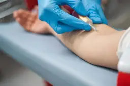 Jakie badania na keto warto wykonać przed rozpoczęciem diety?