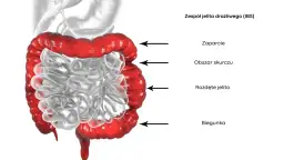 Zespół jelita drażliwego: jakie badania są kluczowe dla diagnozy?