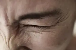 Zez pozorny – czym jest i jak go rozpoznać? Objawy i przyczyny