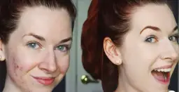 Miya serum rewitalizujące 15 ml - odkryj sekrety pięknej skóry