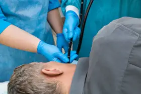 Lekarze w niebieskich rękawiczkach wykonują badanie endoskopowe pacjentowi.