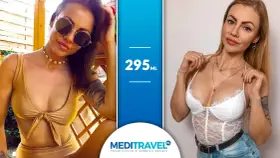 Kobiety prezentujące efekt powiększenia piersi implantami 295 ml. Dwie kobiety w strojach kąpielowych i bieliźnie, podkreślające swoje nowe kształty.
