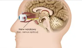 Przekrój głowy z okiem i nerwem wzrokowym. Czy zapalenie nerwu wzrokowego zawsze oznacza SM? Niekoniecznie, ale warto zbadać przyczynę.