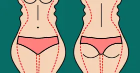 Ilustracja pokazuje sylwetkę przed i po zabiegu liposukcji ud. Czerwone linie zaznaczają obszary do modelowania.