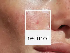 Skóra po dermapenie, widoczne drobne blizny i zaczerwienienia. W ramce napis "retinol", sugerujący pielęgnację.