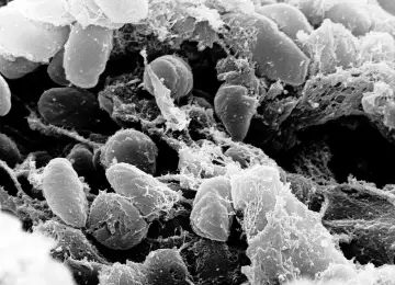 Mikroskopowe zdjęcie bakterii Yersinia pestis, wywołujących dżumę płucną.
