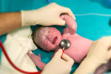 Noworodek po urodzeniu, z zaczerwienioną skórą, płacze, gdy lekarz osłuchuje jego serce stetoskopem.