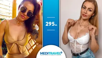 Kobiety prezentujące efekt powiększenia piersi implantami 295 ml. Dwie kobiety w strojach kąpielowych i bieliźnie, podkreślające swoje nowe kształty.