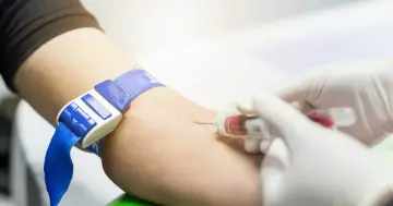 Pobieranie krwi do badań, w tym aptt. Opaska uciskowa na ramieniu, igła i probówka z krwią.