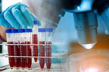 Rękawiczka laboratoryjna trzyma probówkę z krwią na tle mikroskopu.