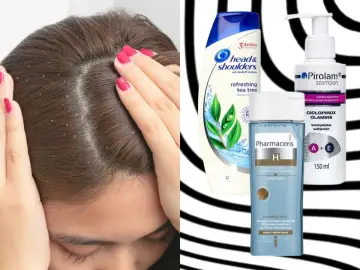 Widoczny łupież na włosach. Obok szampony Head & Shoulders, Pirolam i Pharmaceris, które pomagają zwalczyć problem.