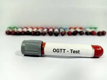 Probówka z oznaczeniem "OGTT - Test" na tle rzędu innych próbek. Wyniki tego testu pozwalają ocenić krzywą cukrową.