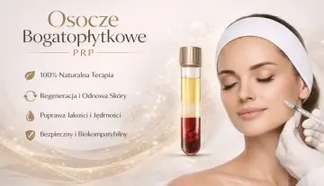 Kobieta otrzymuje zabieg osoczem bogatopłytkowym na twarz. Terapia PRP dla regeneracji i odmłodzenia skóry.