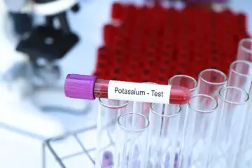 Probówka z oznaczeniem "Potassium - Test" w stojaku, gotowa do analizy pod kątem hipokaliemii. W tle mikroskop i inne probówki.