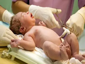 Nowy maminsynek płacze, gdy lekarz przecina mu pępowinę.