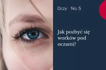 Zbliżenie na niebieskie oko z widocznymi cieniami. Tekst: "Jak pozbyć się worków pod oczami?".