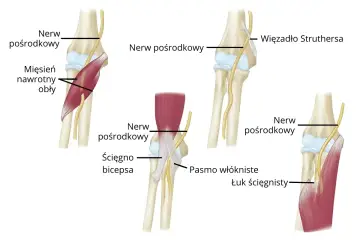 Anatomia łokcia: mięsień nawrotny obły, nerw pośrodkowy, ścięgno bicepsa i więzadło Struthersa.
