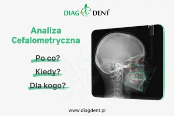 Analiza cefalometryczna: zdjęcie RTG czaszki z naniesionymi liniami i kątami. Pytania: Po co? Kiedy? Dla kogo?