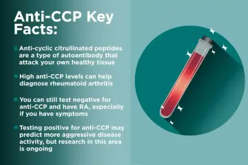 Kluczowe fakty o anty-CCP: przeciwciała atakujące tkanki, wysoki poziom anty-CCP pomaga diagnozować RZS. Test anty-CCP może przewidywać agresywność choroby.